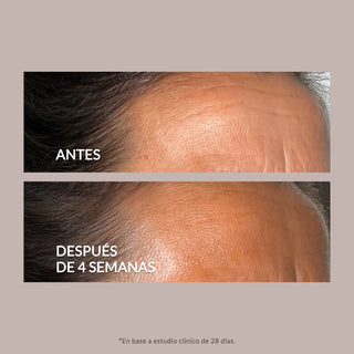 Sérum antiedad con retinal, retinart, péptidos y factores de crecimiento para tratar arrugas  y firmeza.