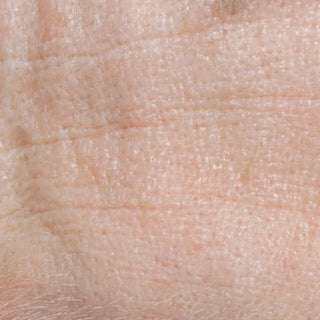 Tratamiento arrugas Byoode