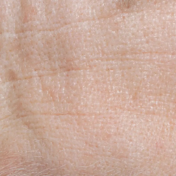 Tratamiento arrugas Byoode